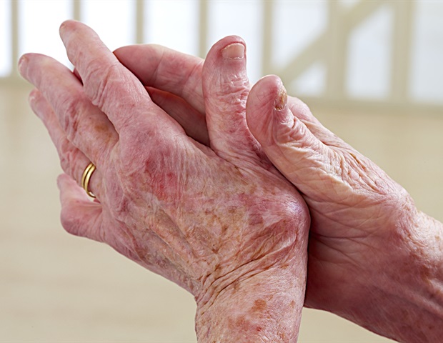 New adaptive finger brace could improve recovery for joint injuries