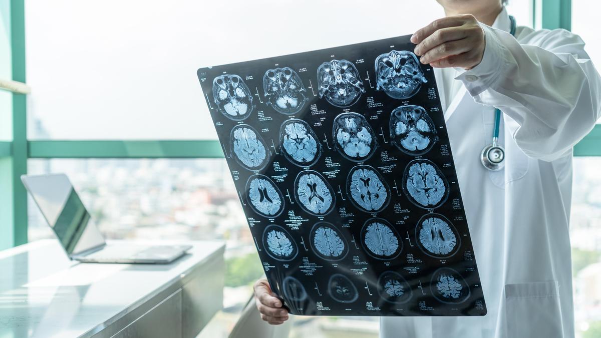 Decoding brain bleeds: evolving treatments promise encouraging results