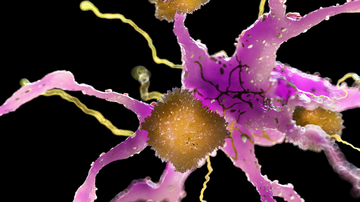New Alzheimer’s Treatment Clears Plaques From Brains of Mice Within Hours : ScienceAlert