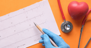 New Calculator To Better Predict Stroke Risk In Atrial Fibrillation Patients