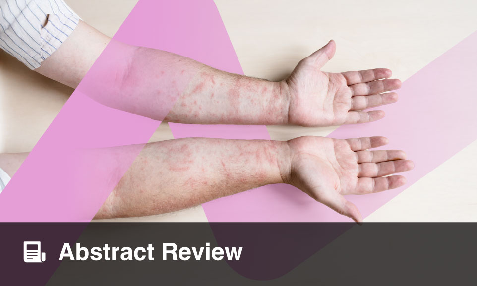 Contact Eczema of the Cheeks Due to Poppy Petal Powder