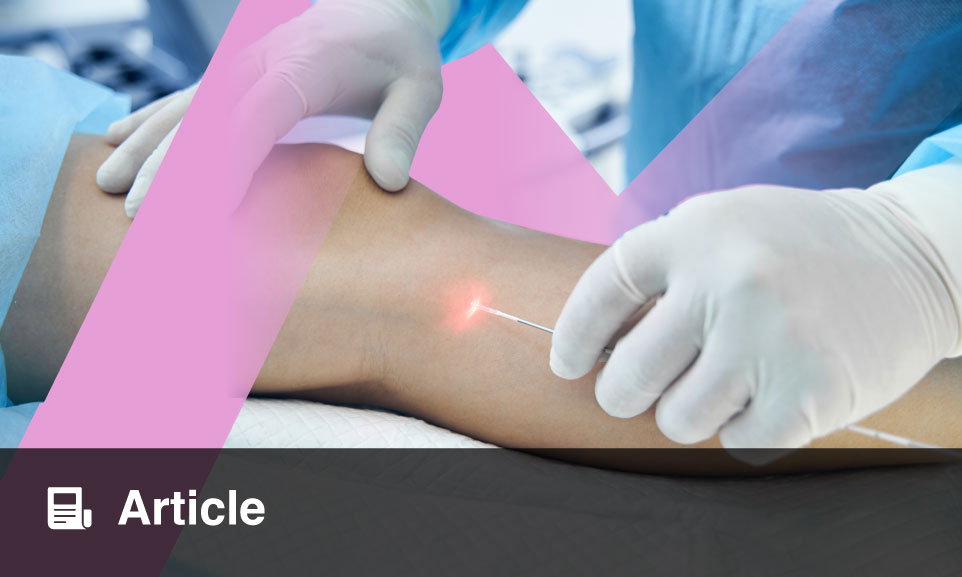 Atypical Koebner Response: Psoriasis Remission Following Endovenous Laser Ablation for Venous Insufficiency: A Novel Case Report and Literature Review