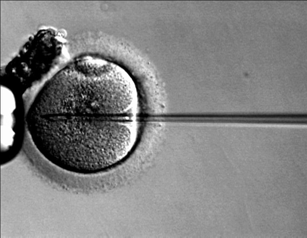 International experts publish guidelines on the administration of gene therapy for hereditary hearing loss