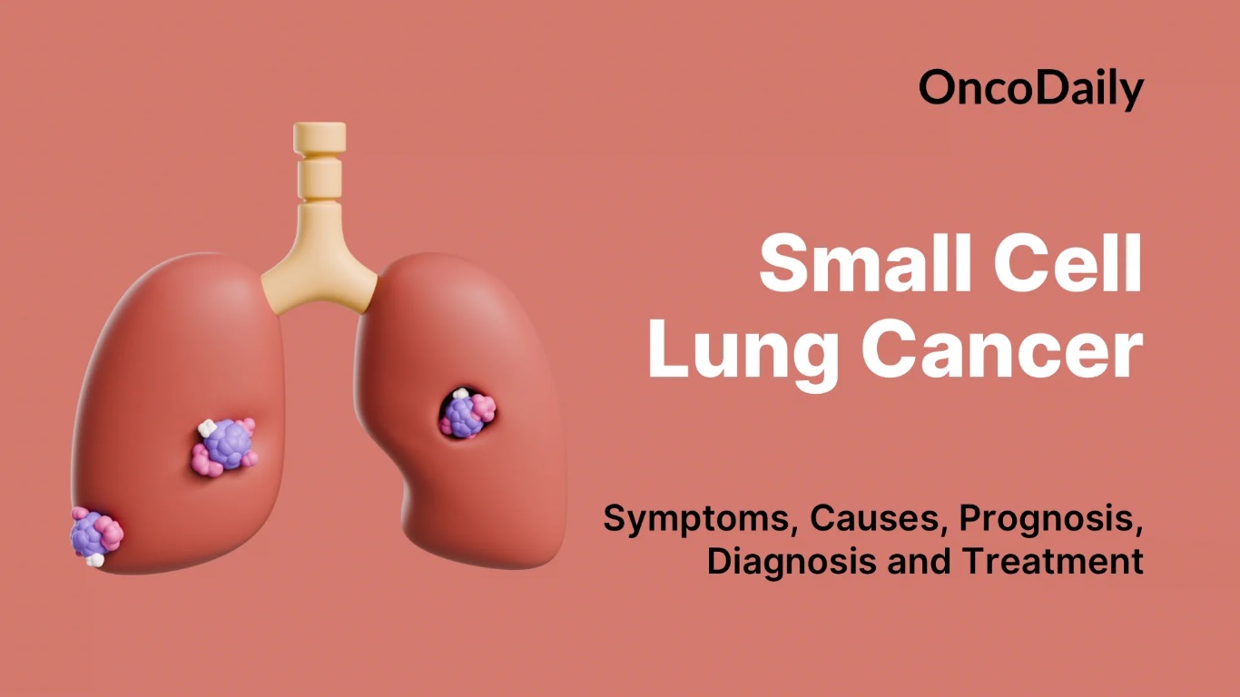 success-rate-of-chemotherapy-for-lung-cancer