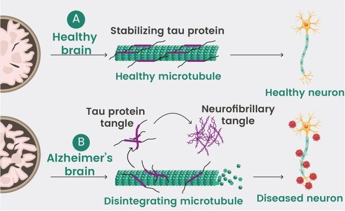 SignalChem’s Tau proteins in neurodegenerative research