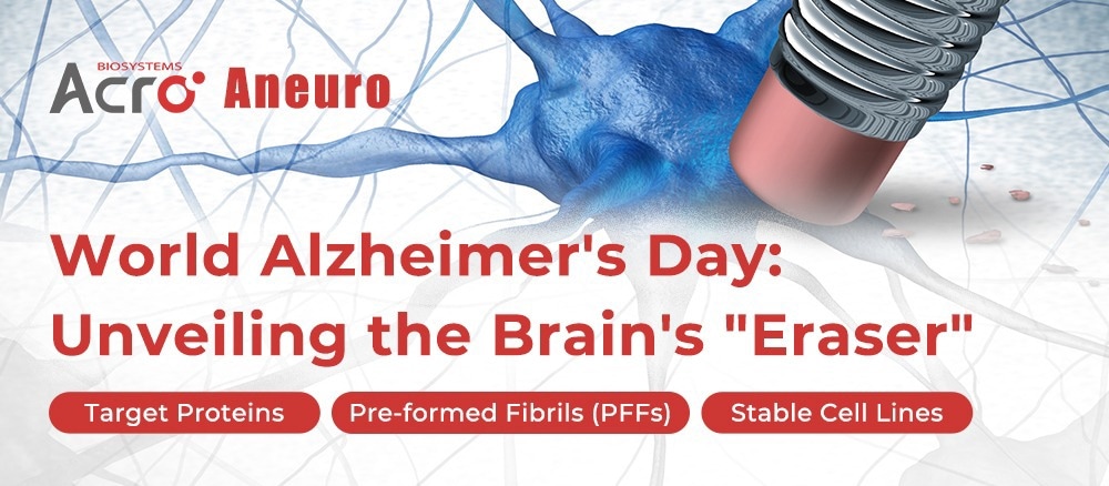 Alzheimer’s disease and the brain’s ‘eraser’