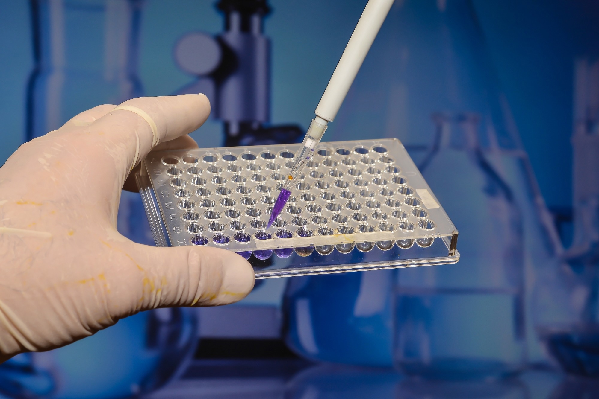 How genomic screening in newborns found 16 hidden disorders standard tests overlooked