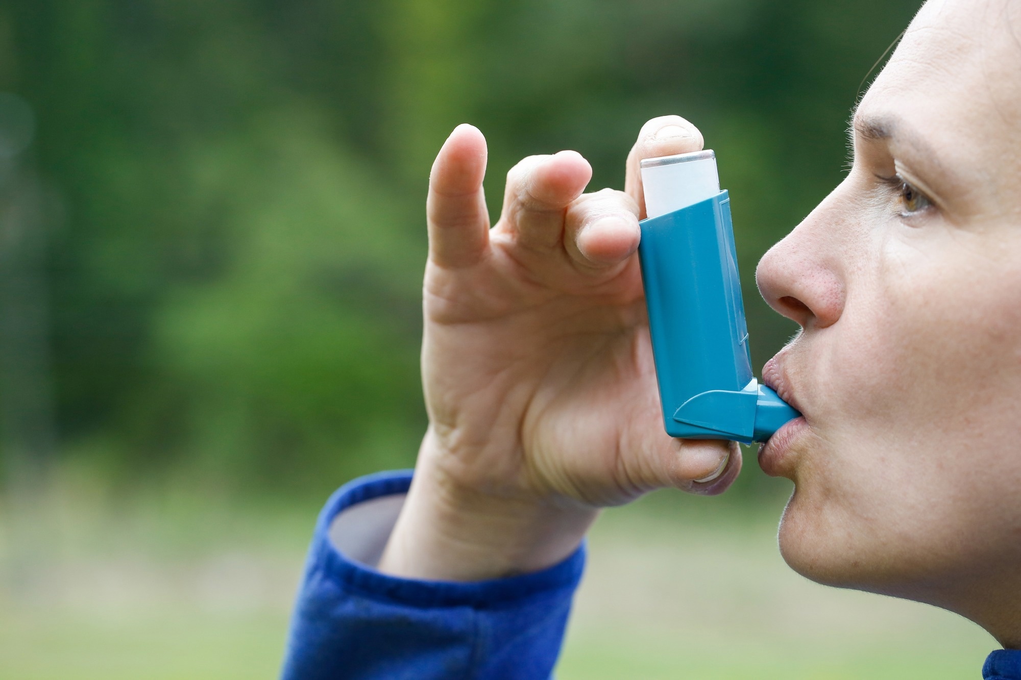 Oral corticosteroids in italy: A persistent asthma solution