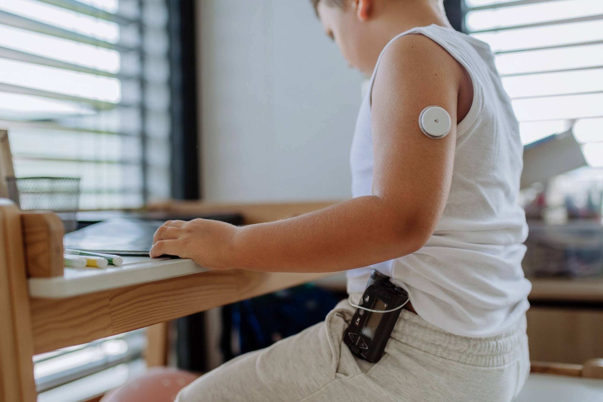 Smarter insulin pump systems help stabilize glucose in young patients, study reveals