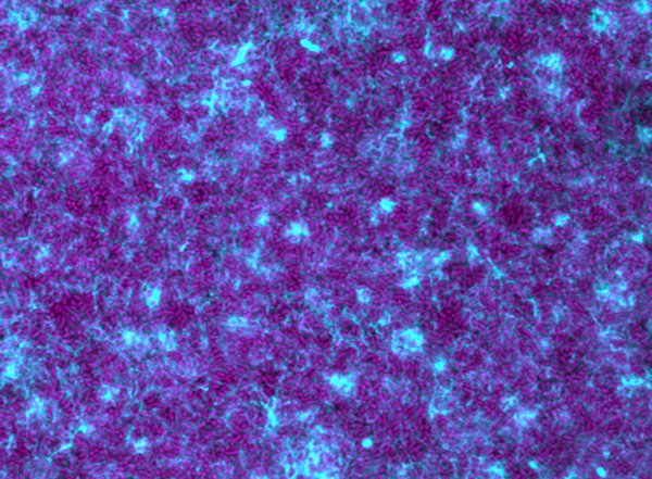 A New Perspective on Bacterial Biofilm Defenses