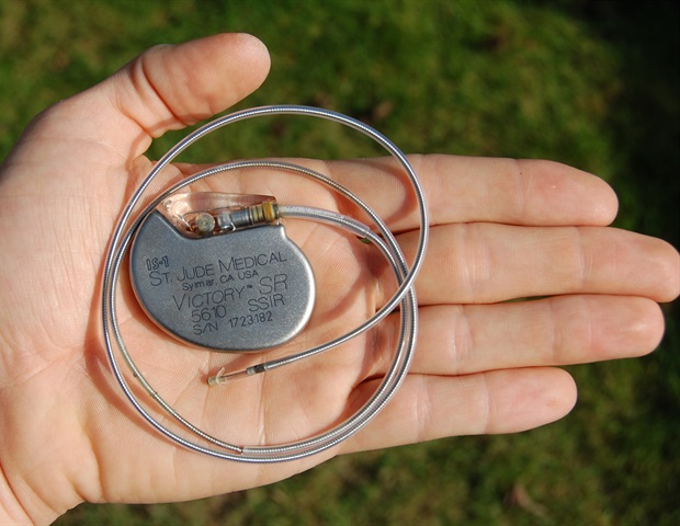 Deep brain stimulation shows promise in reducing severe stuttering
