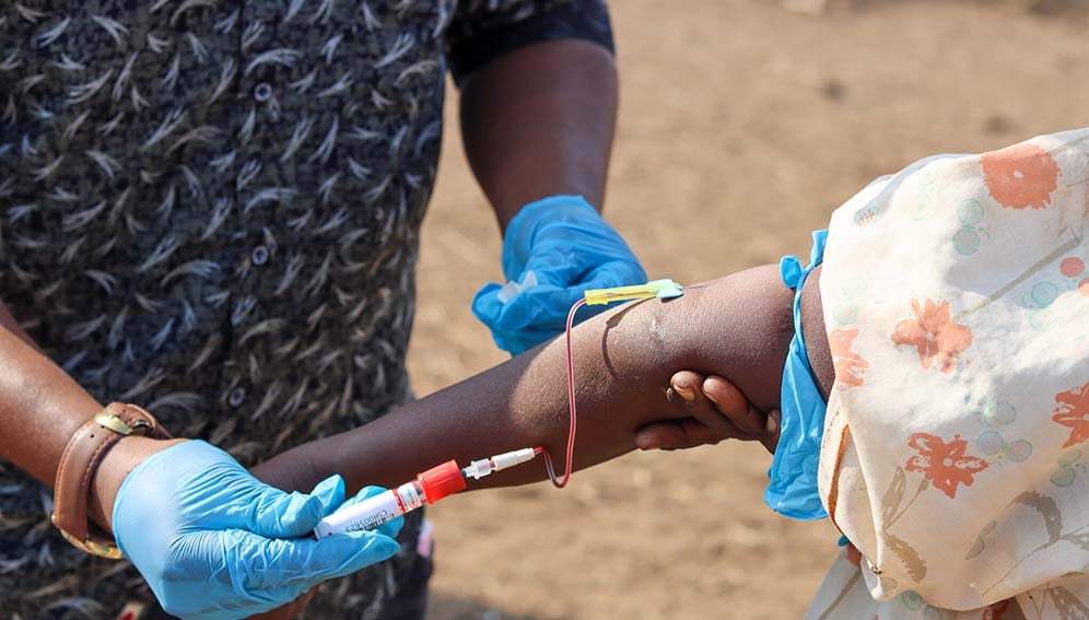 Senegal steps up Rift Valley Fever response
