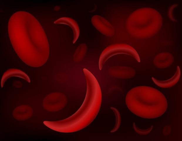 Inappropriate triage prolongs time to pain medication in vaso-occlusive crisis