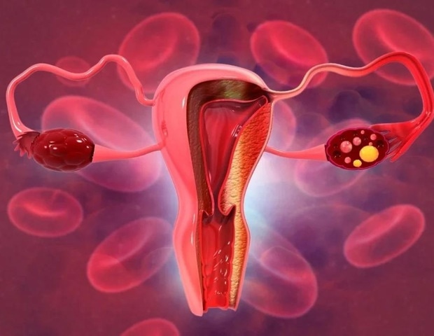 AI brings hope for cervical cancer detection in rural Africa