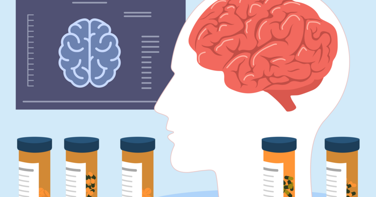 Long-term study challenges assumptions about epilepsy recovery