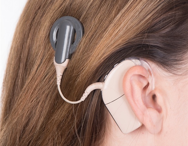 Evaluating the link between sound quality, speech recognition and cochlear implant-related quality of life outcomes