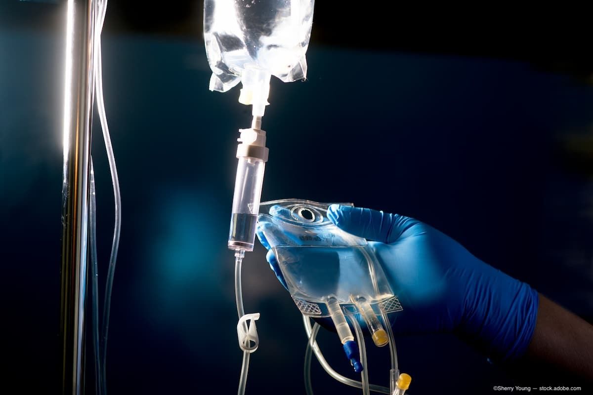 Systemic chemotherapy reduces mortality in retinoblastoma: 30-year analysis from Iran | Ophthalmology Times