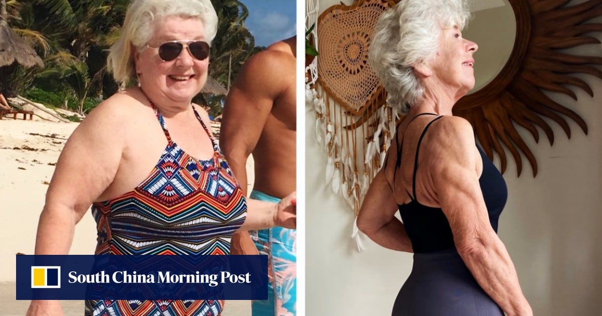 How 79-year-old influencer lost 30kg and now has the bone density of a 20-year-old
