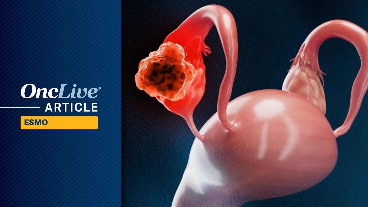 Pembrolizumab Plus Paclitaxel +/– Bevacizumab Yields Survival Advantages in Recurrent PROC