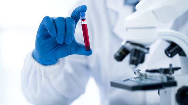 Liquid Biopsy Enhanced by AI Tool