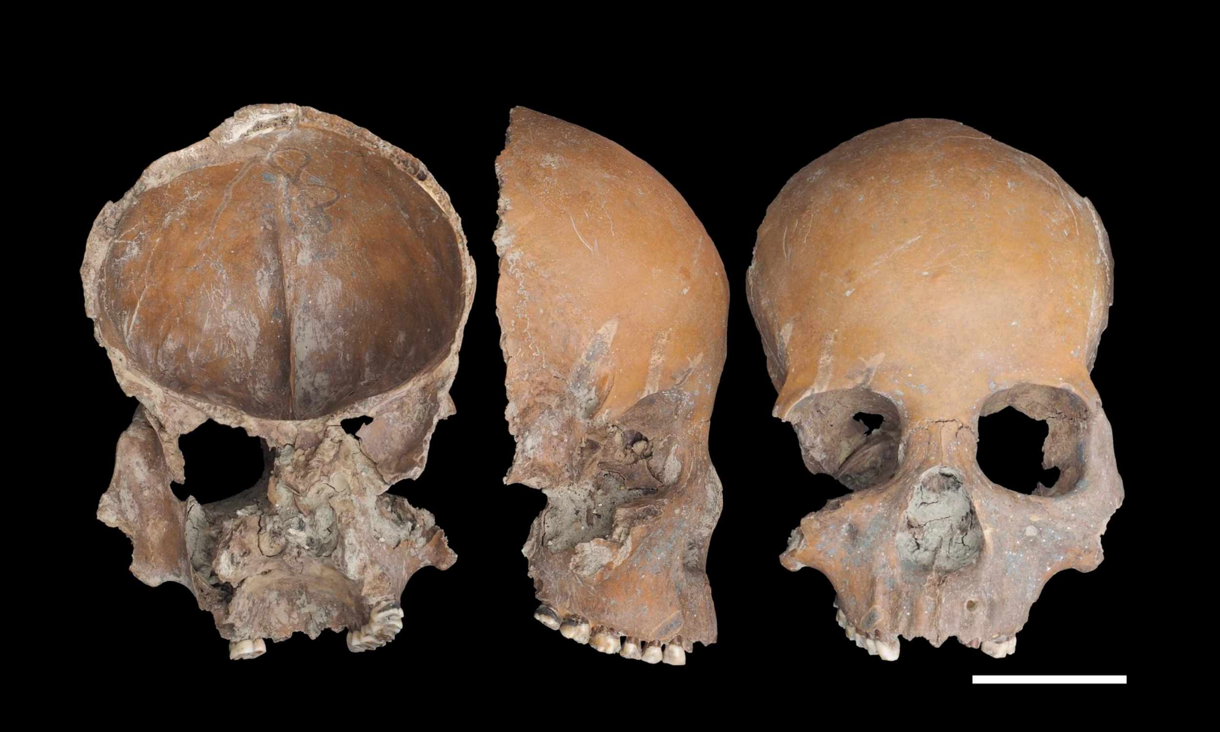 5,000-year-old human skulls were carved into bowls and spoons
