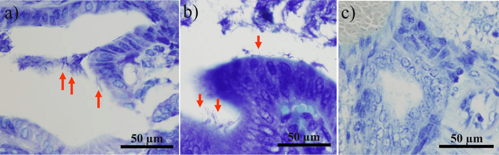 Attempts to Establish a Helicobacter bilis Biliary Tract Infection Model via Oral Administration of Helicobacter bilis