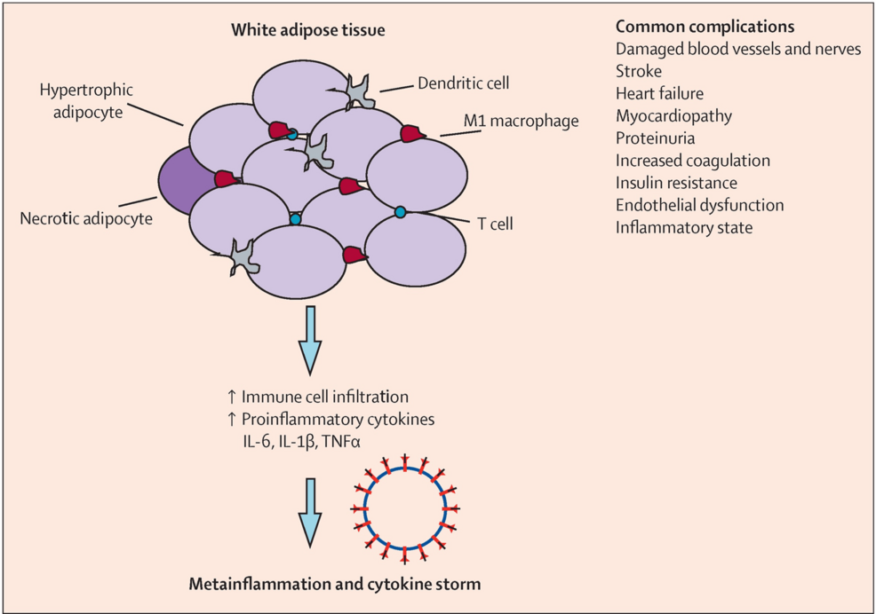 Addressing Meta-Inflammation in the Comprehensive Management of Chronic Pain