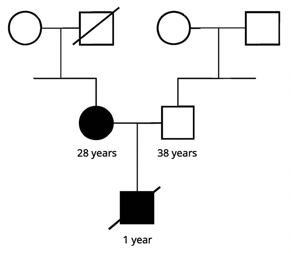 Combined Preimplantation Genetic Testing for Aneuploidy (PGT-A) and Monogenic Disorders (PGT-M) to Prevent Autosomal Dominant Polycystic Kidney Disease After Kidney Transplant