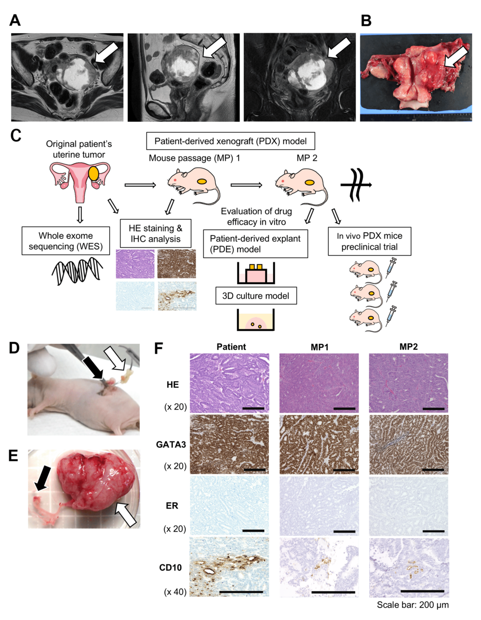 Patient-Derived Xenograft Mouse Model of a Rare Gynecologic Malignancy: Personalized Medicine for the Treatment of Mesonephric-Like Adenocarcinoma