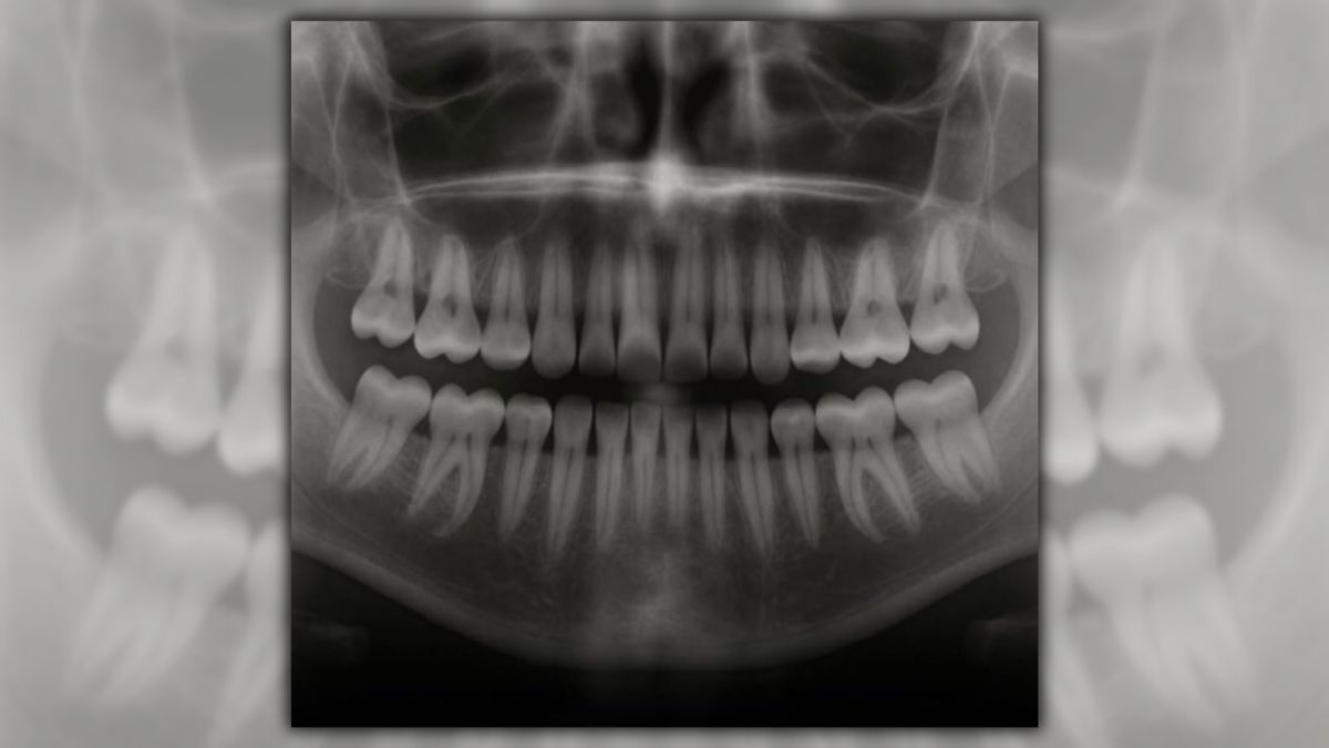 Japanese researchers developed drug that could help people grow new teeth, with conditions