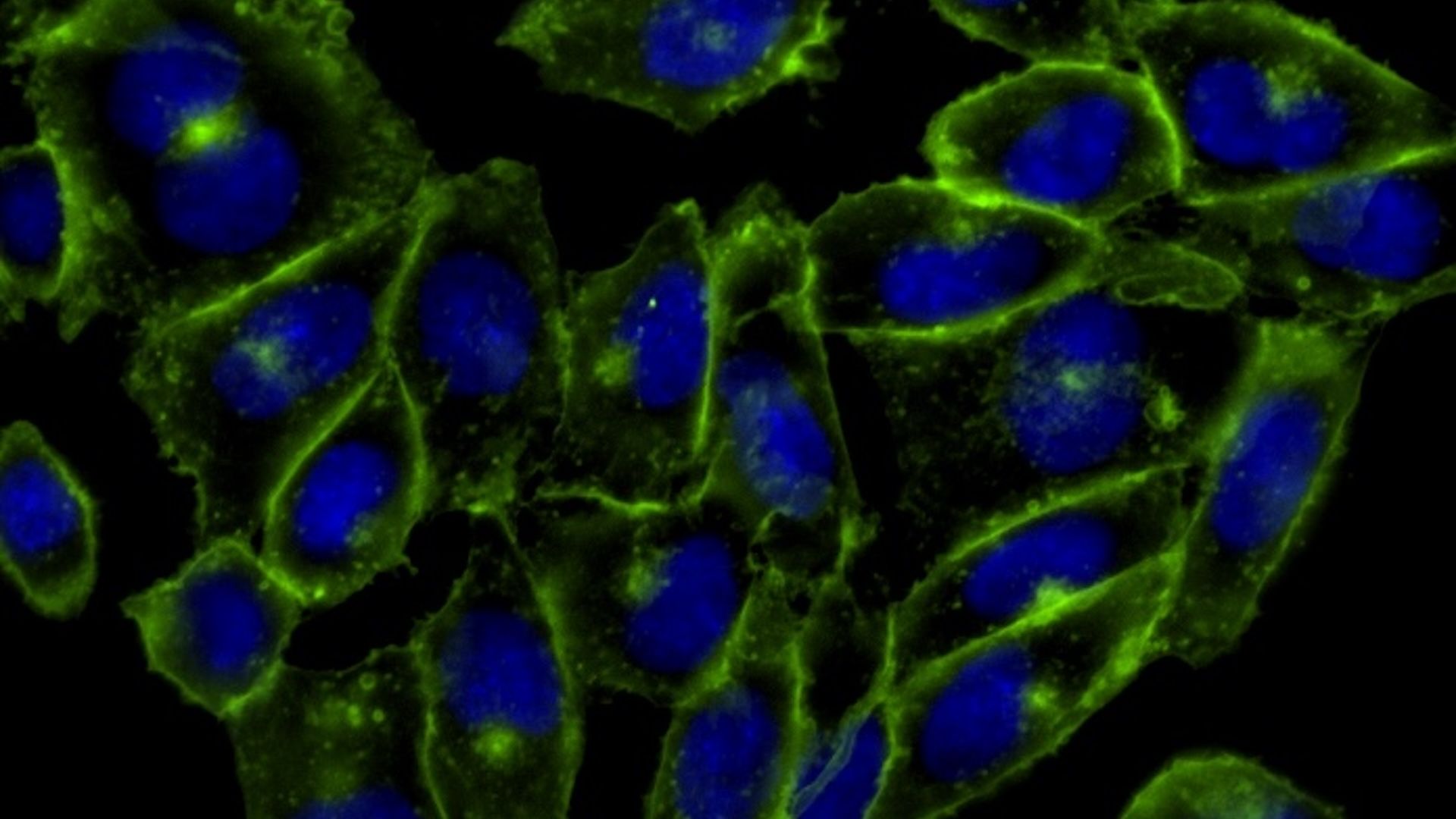 Science history: Scientists use ‘click chemistry’ to watch molecules in living organisms — Oct. 23, 2007