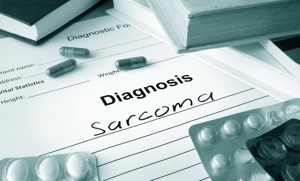 Addressing Psychosocial Barriers Key During Soft Tissue Sarcoma Surgery Recovery