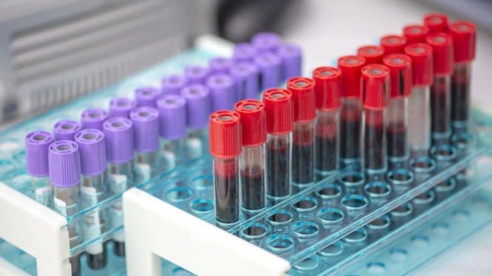 New Blood Test Can Detect 50+ Cancers