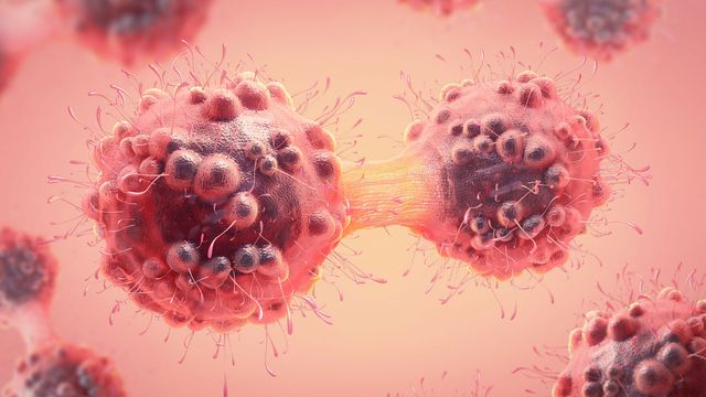 Lipids Are a Key Driver in Triple-Negative Breast Cancer