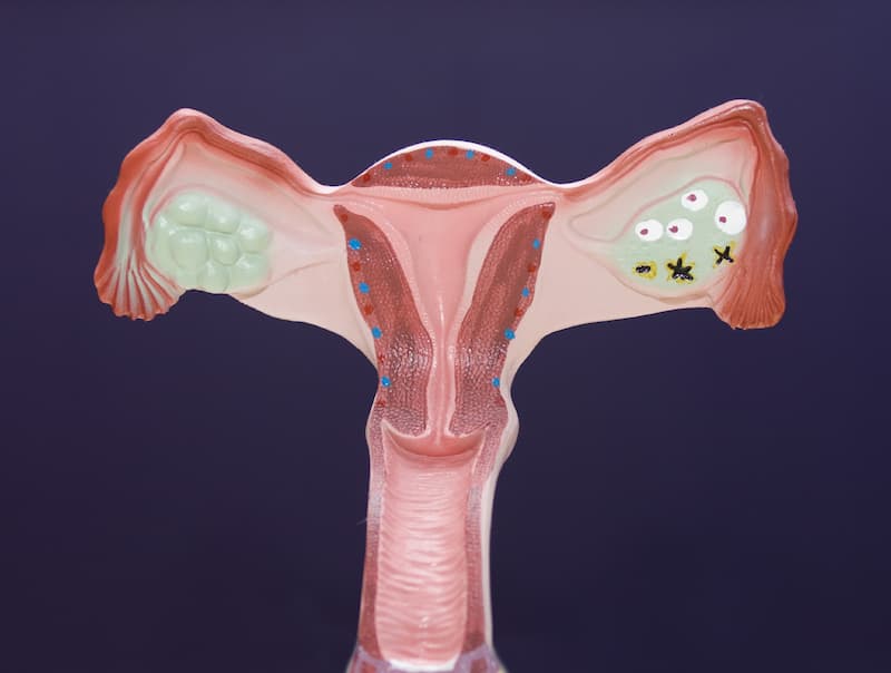 TUB-040 Elicits Early Responses in Platinum-Resistant Ovarian Cancer