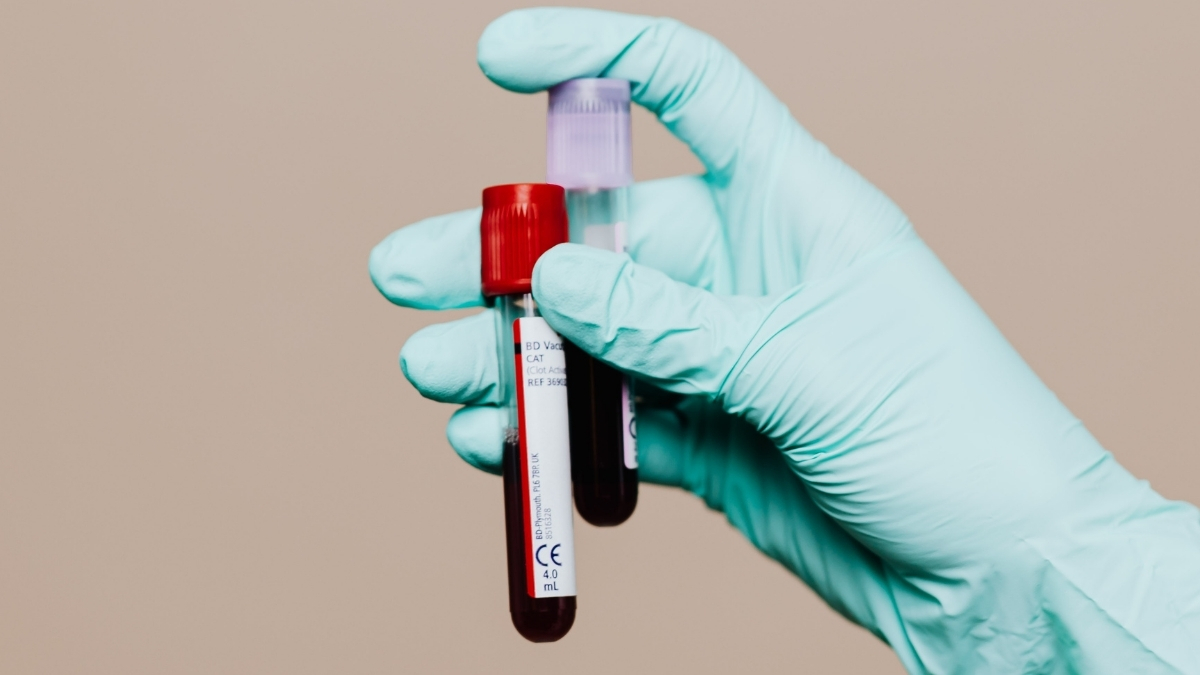 New Chronic Fatigue Syndrome ‘Blood Test’ Raises Hope And Skepticism : ScienceAlert