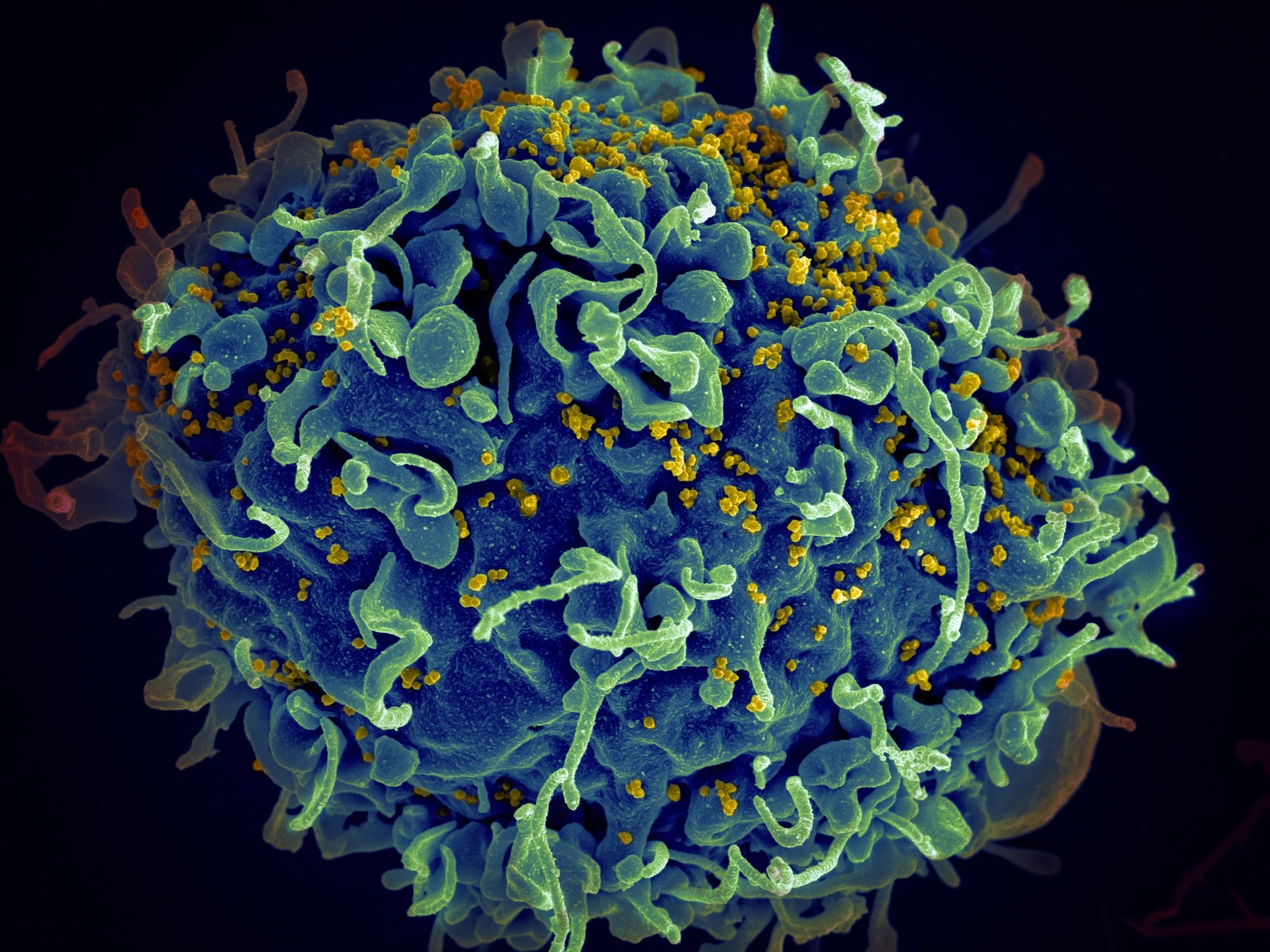 Canadian study reveals where HIV hides in different parts of body