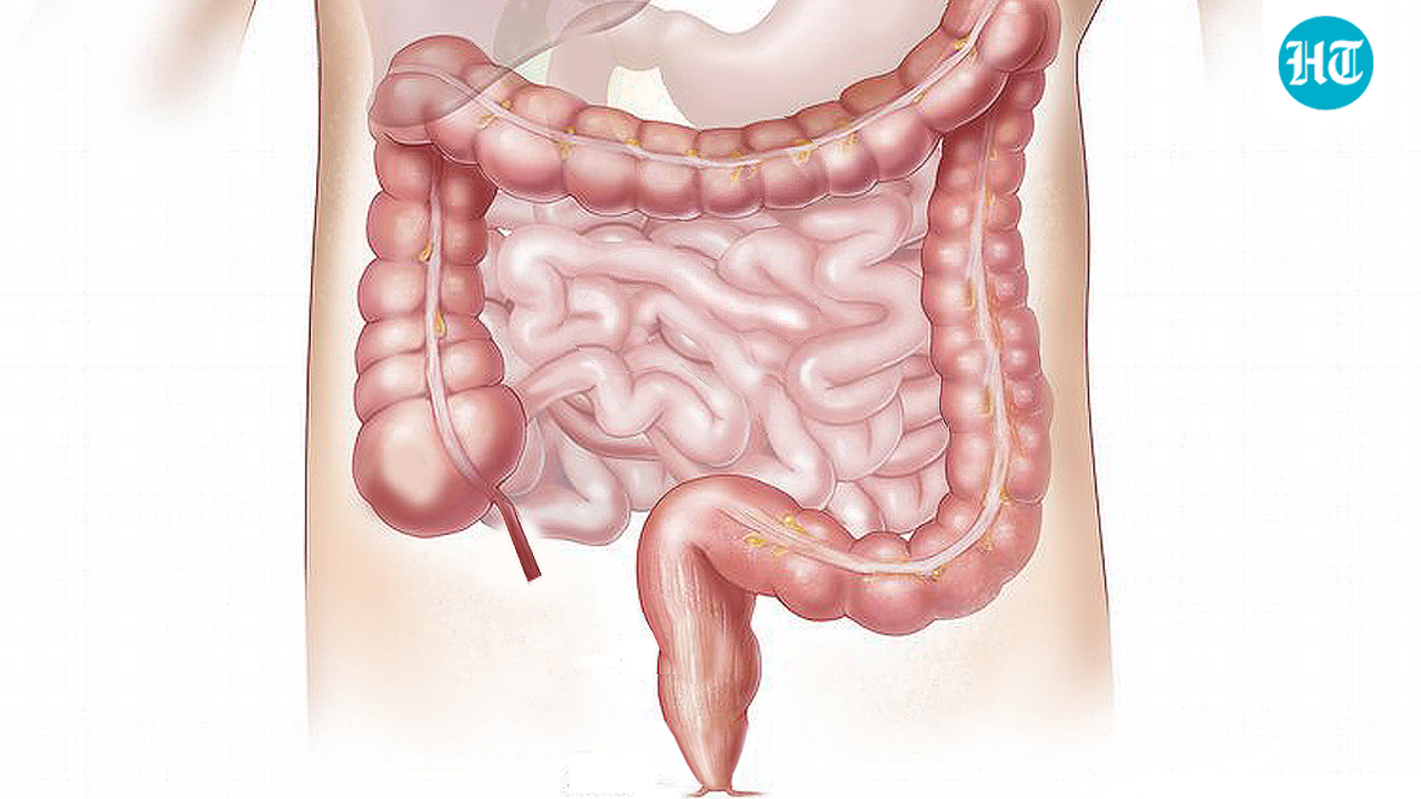 AIIMS gastroenterologist links feeling like you ‘can’t finish’ during bowel movements to colon cancer; shares 8 signs