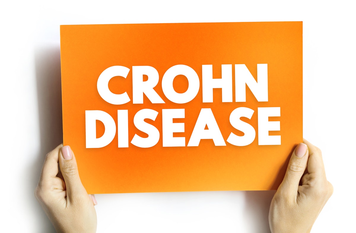MRI, CT, ultrasound biomarkers help identify Crohn disease strictures