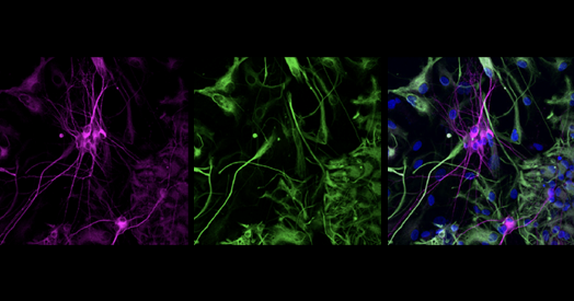 Boosting SCN2A expression reduces seizures in mice