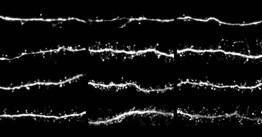 Protein tug-of-war controls pace of synaptic development, sets human brains apart
