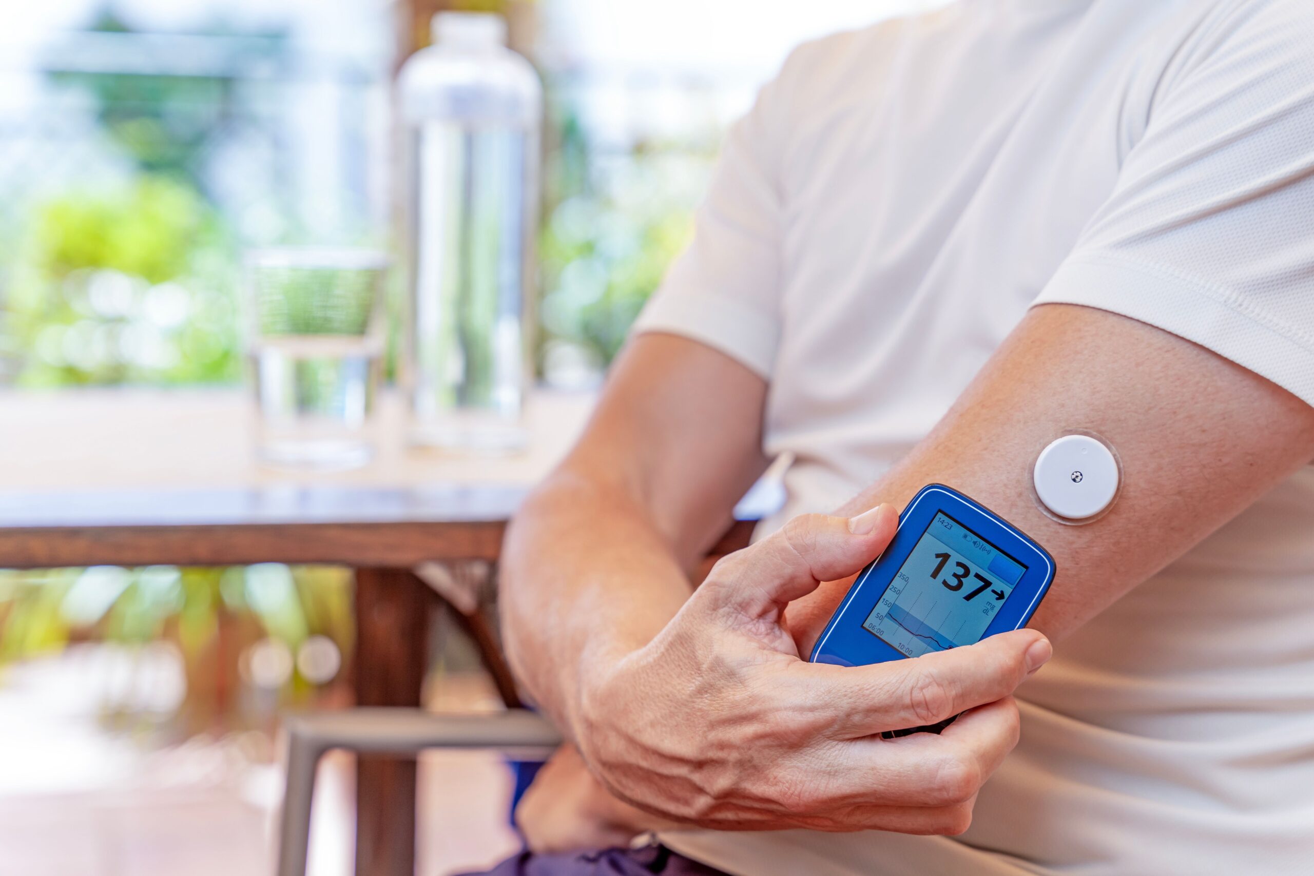CGM-Based Measures Could Improve Detection of Impaired Glucose Regulation