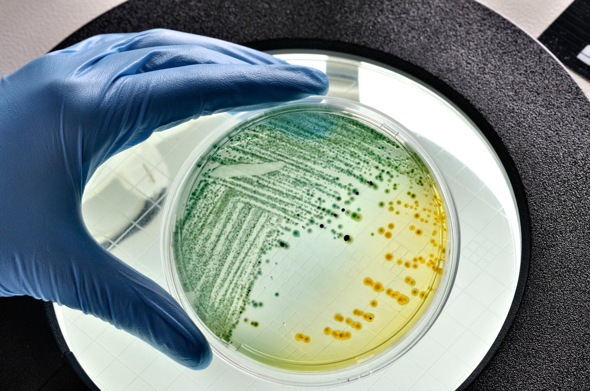 UCSC-led international collaboration sheds new light on bacterial mechanisms of antibiotic resistance