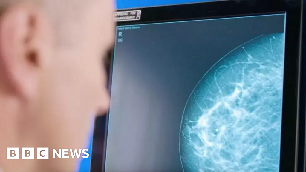Guernsey women asked for breast screening service feedback