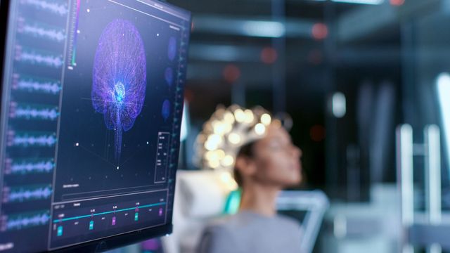Study Explains Why Schizophrenia Patients Hear Voices
