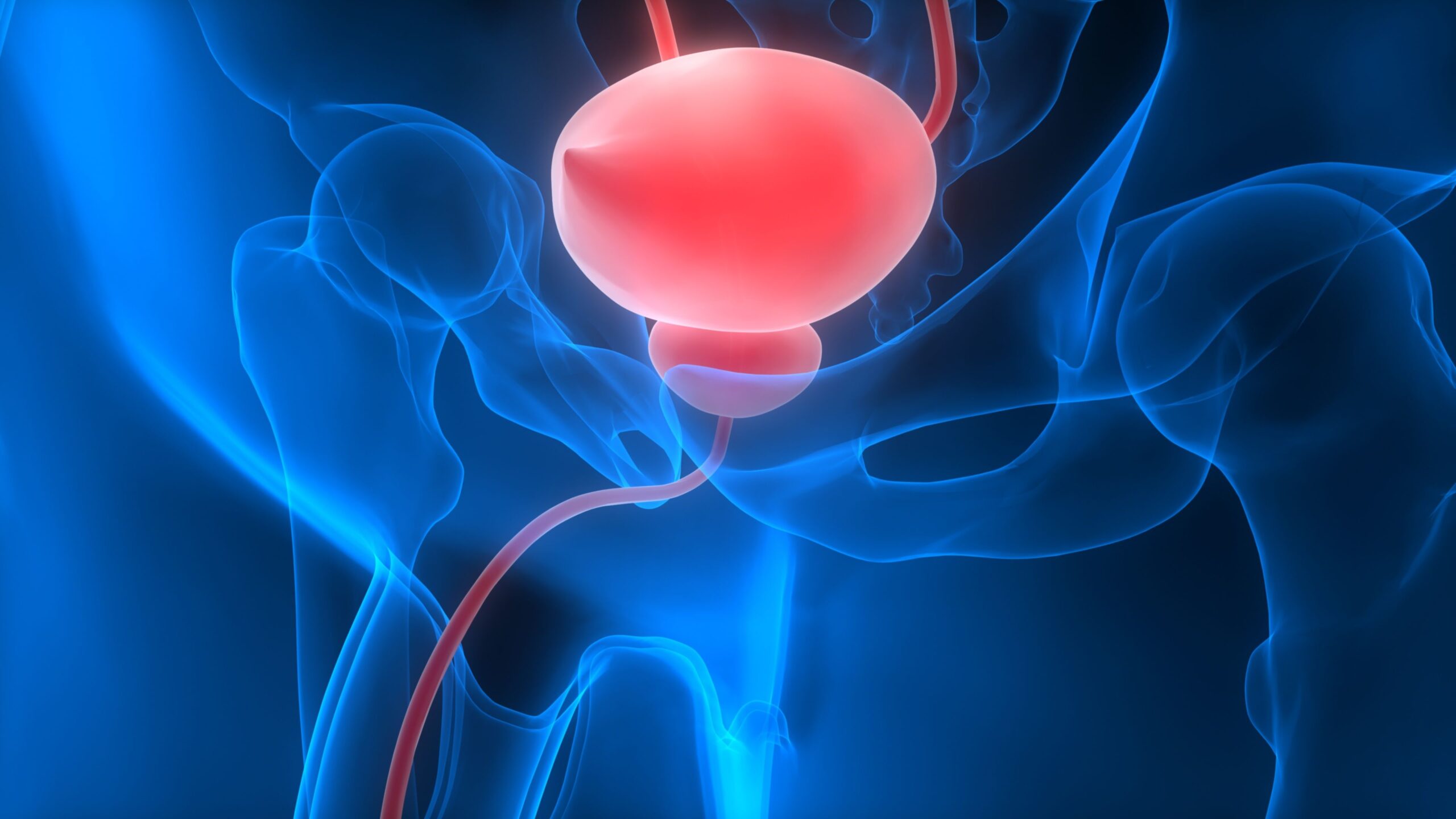Niraparib Combo Boosts rPFS in Metastatic HRR-Altered CSPC