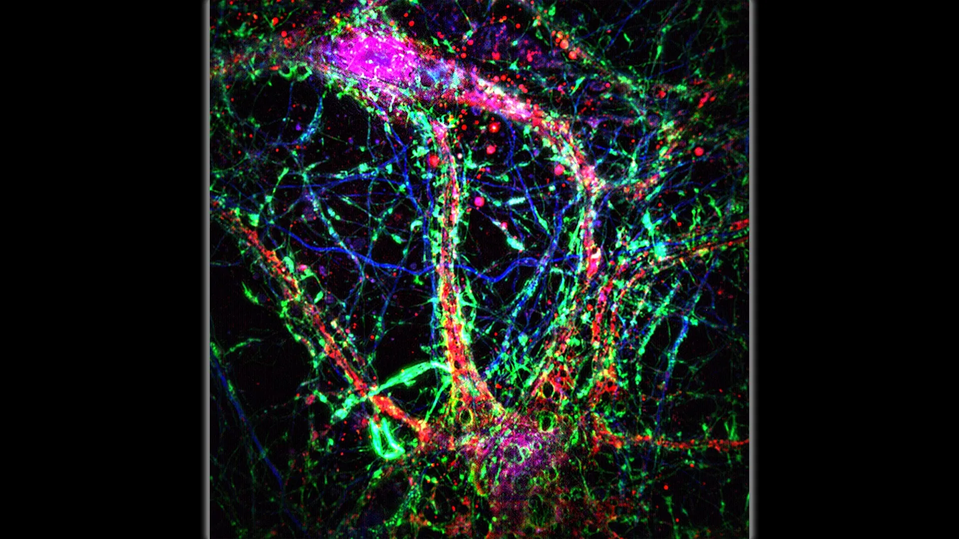 Tiny brain nanotubes found by Johns Hopkins may spread Alzheimer’s