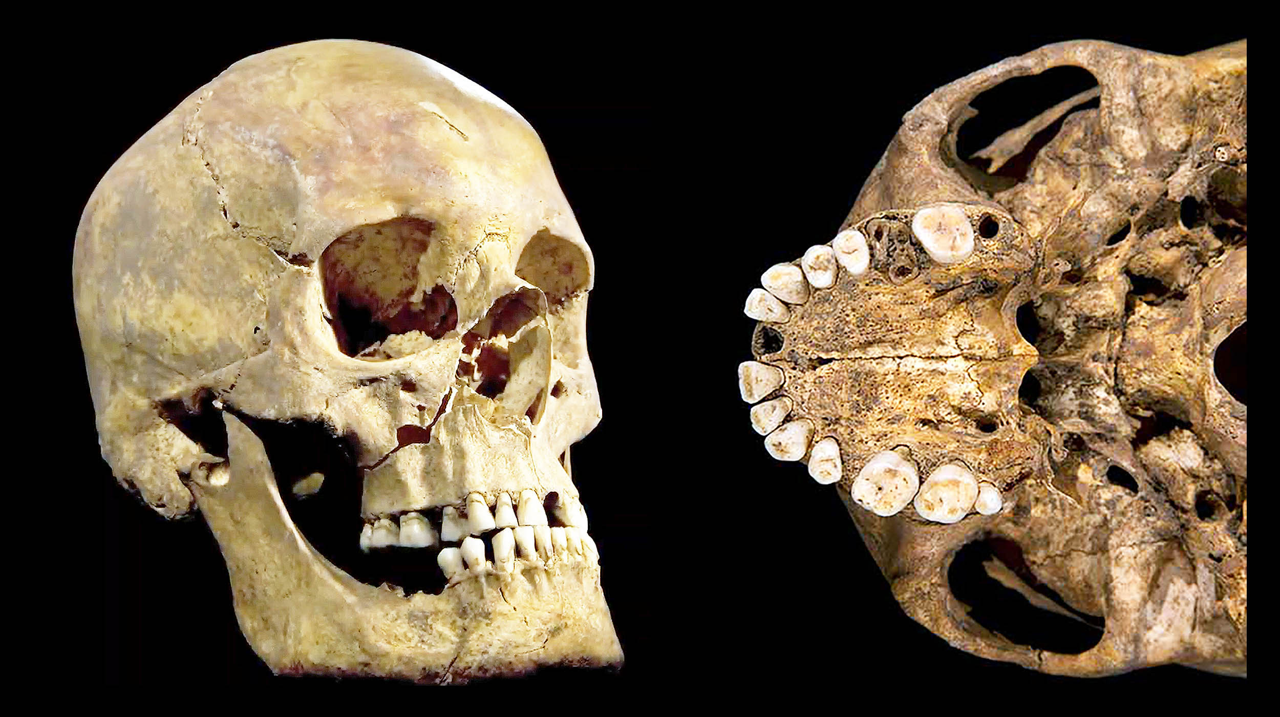 Plaque reveals bacteria that ruled King Richard III’s mouth in 1485