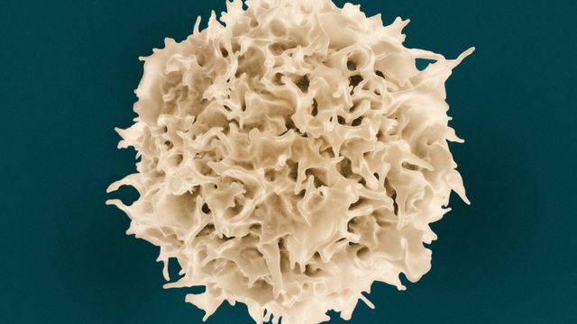 Metabolism Shapes Immune Cell Behavior in Inflammation