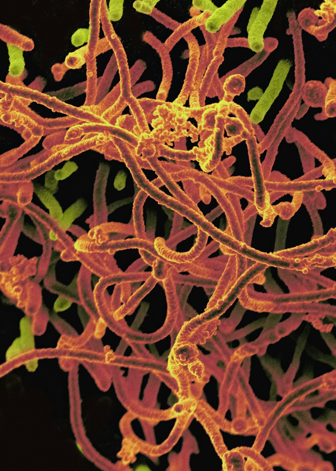 Ebola outbreak reaches 42-day countdown